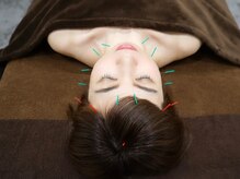 ブルースター/お顔バランス調整美容鍼＊