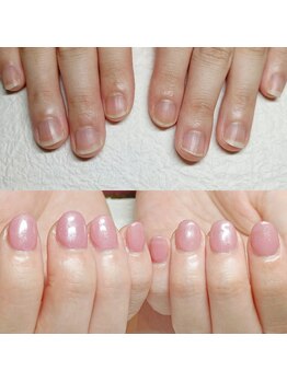 マニエネイル(mani e nail)/深爪矯正で美爪育成/丁寧ケア