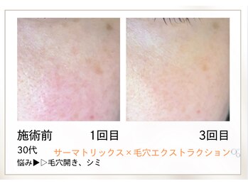 リル(Rire)/Before→After