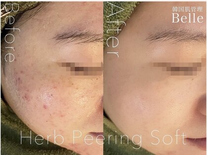 ベル 本厚木(Belle)の写真