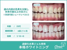 クレア(Crea)/【ホワイトニング症例写真】