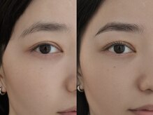 ネストアイ(NEST eye)