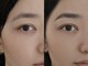 ネストアイ(NEST eye)の写真/元々持っている魅力を引き出すデザイン