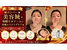 ラ コンシェル たまプラーザ店/スペシャルケアの鍼ボンバー！