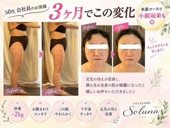 ヨサパーク ソルナ(YOSA PARK Soluna)の写真/完全個室◎【滝汗デトックス×リンパケア】で代謝UP！脂肪燃焼＋本気痩せを徹底サポート！！