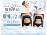 【脂肪冷却】気になる部分集中！人気の冷却痩身２Cup￥8800当日４Cup変更OK！