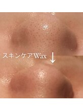 マイン 幸店/スキンケアWax