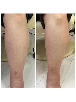 ドクターネイル爪革命 十条店/フットリフレ