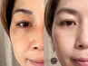 《1番人気》【(Lit)ヒト臍帯幹細胞エステ】シミしわ毛穴悩み改善(90分)