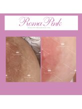 ニューラインアイプラス トウキョウ(New Line eye+ Tokyo)/ローマピンク【ニップル】