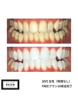 レオン 磐田(REON)/◇ お客様 before＆after ◇