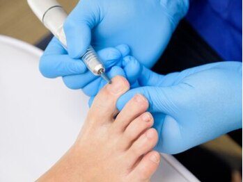 巻き爪補正店 松本店の写真/【分厚い爪・深爪・変色爪でお悩みの方へ◎】なかなか改善しなかったお悩みは豊富な経験と技術で改善!