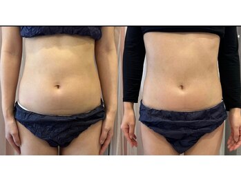 ココカラ(COCOKARA)/お腹周りスッキリ