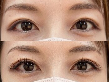 ロエン 北岡崎(ROEN)/フラットラッシュ120本