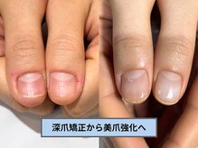 アリエ(allie)/ピアノを弾く指先に自信がもてた