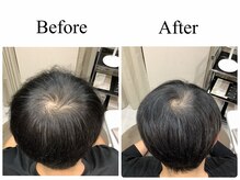 アンス(anth:)/お客様仕上がり