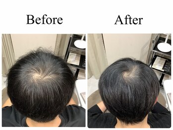 アンス(anth:)/お客様仕上がり