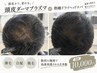【メンズ人気No.1】抜け毛/白髪/フケ◎頭皮ダーマ+熟睡ドライヘッドスパ