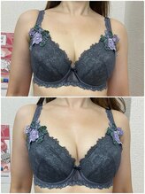 バーディー(BIRDIE)/施術１回/4０代