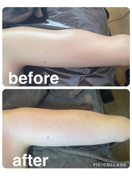 ギンザアール(GINZA R.)/二の腕集中ケア！