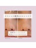 【シミ・シワ・たるみ改善・ニキビケアに】光フェイシャル¥12800