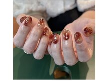 ハイム バイ トレンチ(Heim by trench)