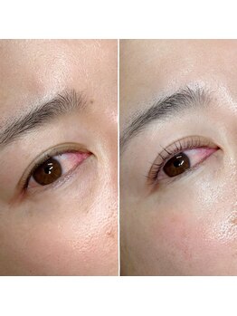 エタビー(etebe)/