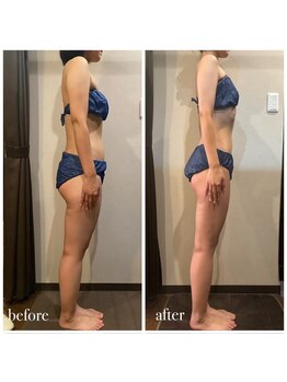 シュールサエラ 枚方店/ブライダルに向けて最強痩身!