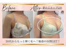 リーズリアン(Rises Lien)/【BeforeAfter】30代 バストUP!