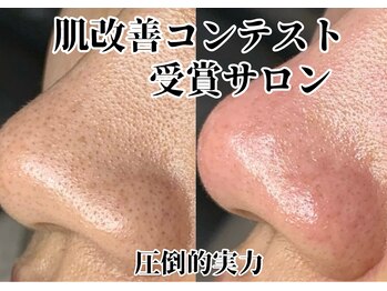 ジューンブライド(June Bride 61)/毛穴ケア