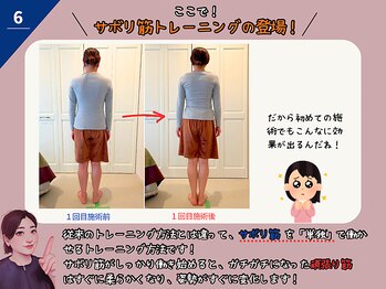 ラシュシュ/サボリ筋とは？