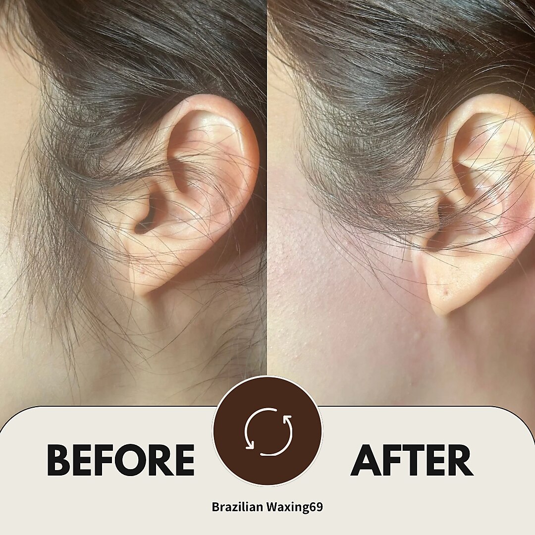 ブラジリアンワキシング シックスナイン(BrazilianWaxing69
