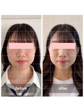 シー 下北沢(sea)/たった1回の施術見違える変化◇