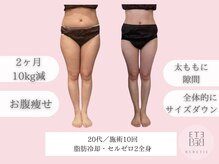 ベベティー(BEBETIE)/セルゼロ2・脂肪冷却で短期痩せ