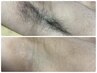 【汗、ニオイ対策】ワキ脱毛　7700円→4400円