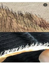 ソワイユ 浜松店(Soyeux)/ ワックス脱毛（wax &nbsp;xxx）お髭