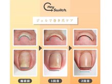 巻き爪ケアの出来る特殊ジェル！ヘイスイッチジェル取り扱い