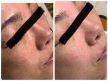 ベルドア(Bell Door)/美白/くすみケア