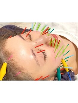 鍼灸施術を受けたい