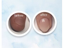 【深爪ケア】ワンカラースカルプ