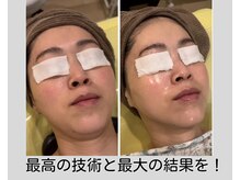 ルリール(Le Rire)の雰囲気（確実に結果を出しながら眠れるほどの気持ちよさ♪）