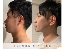 ゼロ アンド リセット(0ZERO&RESET)/【メンズ脱毛】0ZERO&RESET