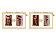 ベルシア 吉祥寺店(BELCIA)/劇的変化体型別ビフォーアフター