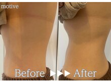 美バリ 四条烏丸(美VARI)の雰囲気（肥満DNA検査で自分の痩せる食材でダイエット成功に導く！）