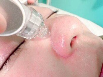 エースタイル(a-style)の写真/最新マシンで気になる毛穴の悩みを徹底改善★お肌の内側からハリ&透明感UP♪施術後からお化粧OK◎