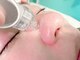 エースタイル(a-style)の写真/最新マシンで気になる毛穴の悩みを徹底改善★お肌の内側からハリ&透明感UP♪施術後からお化粧OK◎