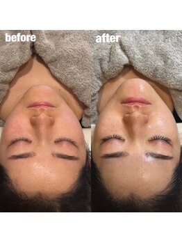 ペネロピ(Penelope)/フラットラッシュ×ララピール