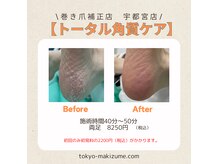 巻き爪補正店 宇都宮店