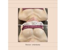 ロココ 横浜店(Rococo)