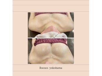 ロココ 横浜店(Rococo)の写真/【自信を取り戻す、大人のための育乳ケア】自分史上最高の美乳シルエットで理想の自分へ。